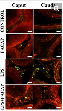 CD45 Antibody - Figure 6.