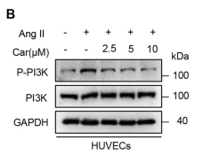 PI3K p85/p55 Antibody - Fig.