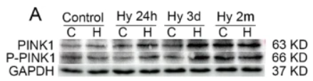 Phospho-PINK1 (Ser228) Antibody - Fig.