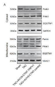 Parkin Antibody - Fig.