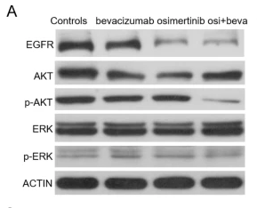 Phospho-AKT1 (Thr308) Antibody - Fig.