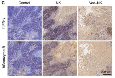 Interferon gamma Antibody - Figure 6 The combined therapy mobilizes both T cell and NK cell immunity against EBV+ NPC in humanized mice (A) Quantification of the serum concentrations of human IFN-γ (left) and human TNF-α (right) in humanized mice from each group (ordinary one-way ANOVA with Tukey’s multiple comparisons test; ns, no significance; p > 0.