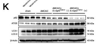 SQSTM1/p62 Antibody - Fig.