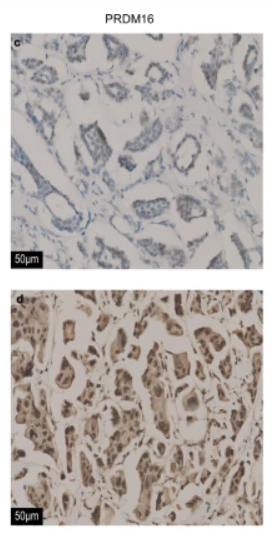 PRDM16 Antibody - Fig.