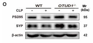 Synaptophysin Antibody - Fig.