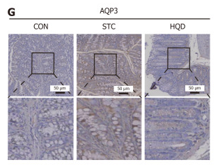 AQP3 Antibody - Figure 6.