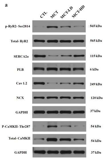 RYR2 Antibody - Fig.
