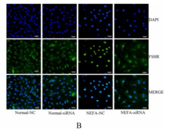 FSHR Antibody - Fig.