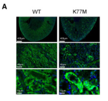 TCN2 Antibody - Figure 5 Phenotypes and pathological changes of TCN2 K77M mice and their diabetic models (A) Representative images of immunofluorescence staining of TCN2 in WT and TCN2 K77M mice at indicated magnifications.