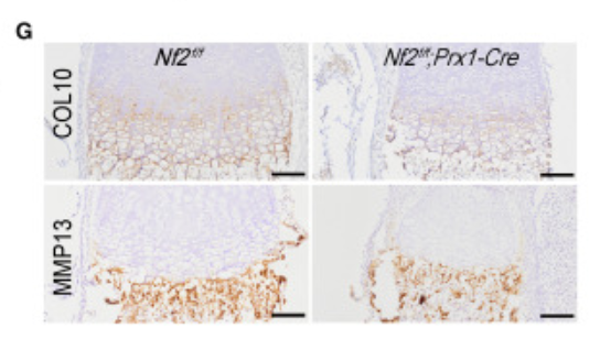 Collagen XIII  alpha 1 Antibody - Figure 2 Merlin deficiency impairs chondrocyte proliferation and hypertrophy (A) EdU incorporation and staining in E18.