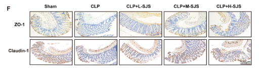 ZO 1 Antibody - Fig.