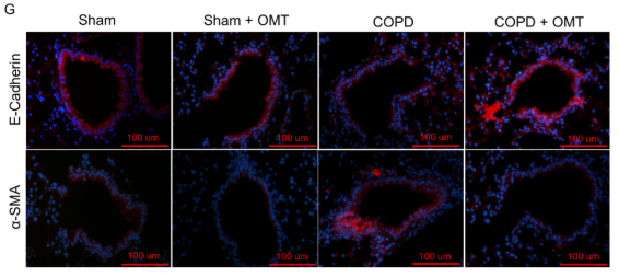 alpha-SMA Antibody - FIGURE 2 OMT treatment ameliorates CS-induced pulmonary fibrosis and EMT in COPD mice.