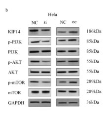 Phospho-AKT1/2/3 (Ser473) Antibody - Figure7 RCN1 regulates the PI3K-AKT signaling pathway by targeting KIF14 a Effects of RCN1 knockdown and overexpression on key proteins in KIF14, PI3K/AKT/mTOR pathway in C33A cells.