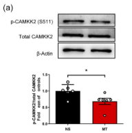 CAMKK2 Antibody - FIGURE 8 The changes of CAMKK2 in SH-SY5Y cells and spinal cord and the effect of CAMKK2–AMP-activated protein kinase (AMPK) on microtubules in SH-SY5Y cells.