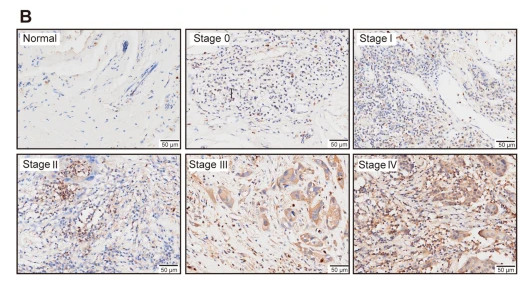 PYGL Antibody - Fig.