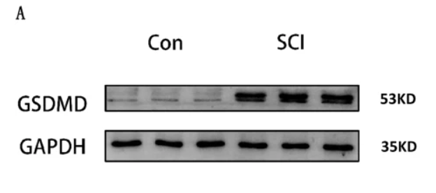 GSDMD Antibody - Fig.