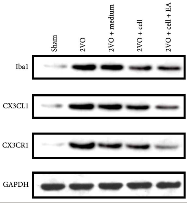AIF1/IBA1 Antibody - Figure 3 (A) Detect the expressions of microglia marker Iba1, chemokine CX3CL1, CX3CR1 in the hippocampus of each group by western blot.