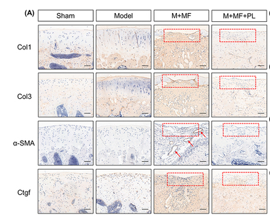 Collagen I Antibody - Figure 4 Effects of MF treatment and combined treatment of MF with PL on expressions of Col1, Col3, α-SMA and Ctgf on rat cartilage.