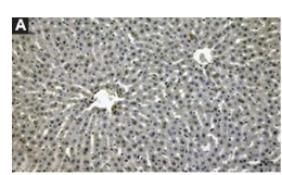 Nrf2 Antibody - Figure 4 Immunoexpression of oxidative stress marker of Nuclear factor erythroid 2-related factor 2 (Nrf-2) in hepatic tissues of control (A), cyclophosphamide (CP) (B) and CP + rosmarinic acid (RA) (C) groups, scale bar: 50 μm, magnification: ×20; (D) Immunostaining scores in groups; (E) Intersection of RA protein targets with Nrf-2.