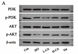 Phospho-AKT1 (Thr308) Antibody - Fig.