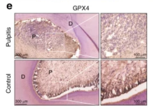 GPX4 Antibody - Fig.