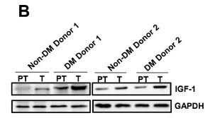 IGF1 Antibody - Fig.