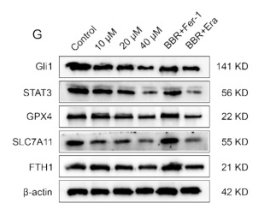 Phospho-STAT3 (Tyr705) Antibody - Fig.