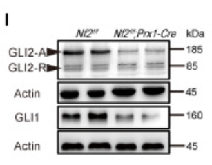 Gli1 Antibody - Figure 3 Merlin deficiency impairs HH signaling activation in vitro (A–D) Bulk RNA sequencing (RNA-seq) of Nf2f/f and Nf2f/f;Prx1-Cre primary chondrocytes.