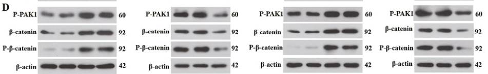 PAK1 Antibody - Figure 4.