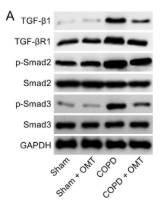 Phospho-Smad2 (Ser467) Antibody - FIGURE 5 OMT treatment inhibits the TGF-β1/Smad signaling pathway.