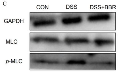 Phospho-MLC2 (Ser15) Antibody - FIG 8 Alterations of distal colon smooth muscle contraction.