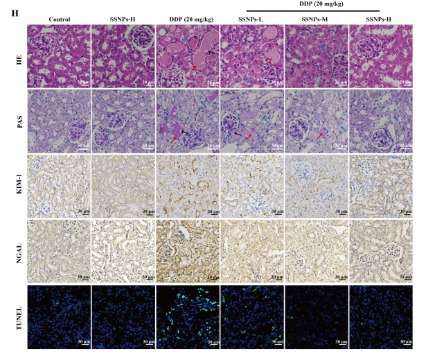 LCN2 Antibody - Figure 3.