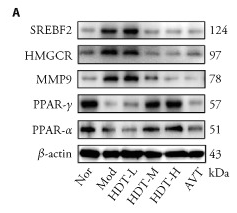 SREBP2 Antibody - Figure 4.
