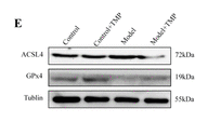 ACSL4/FACL4 Antibody - Figure 8.