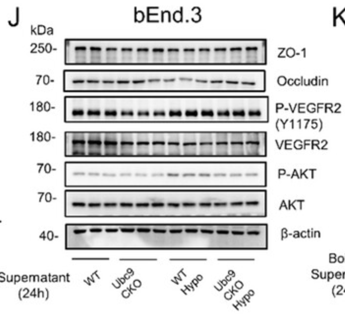VEGFR2 Antibody - Figure 4 Depletion of UBC9 reverses the phenotype of pro-angiogenic MNPs with lower VEGFA levels under hypoxic conditions.