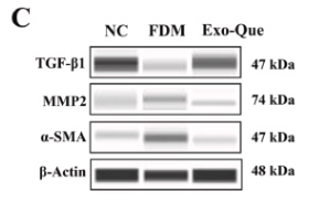 TGF beta 1 Mouse monoclonal Antibody - Fig.