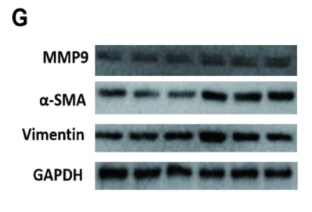 Vimentin mouse monoclonal Antibody - Fig.