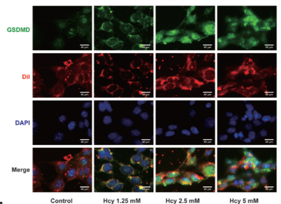 GSDMD Antibody - Figure 2 Effects of homocysteine (Hcy) on the expression and the membrane localization of GSDMD in HT22 cells.