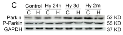Phospho-Parkin (Ser65) Antibody - Fig.