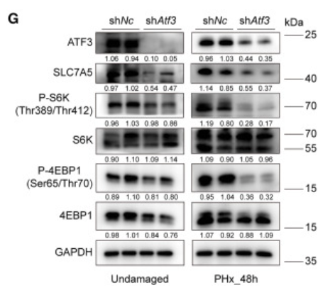 Phospho-p70 S6 Kinase (Thr389/Thr412) Antibody - Figure 5 ATF3 activates its expression and the mTOR pathway by binding to the promoter of Slc7a5 (A) Slc7a5 regions associated with ATF3 binding as determined by ChIP-qPCR analysis.
