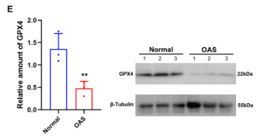 GPX4 Antibody - Fig.