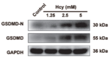 GSDMD Antibody - Figure 2 Effects of homocysteine (Hcy) on the expression and the membrane localization of GSDMD in HT22 cells.