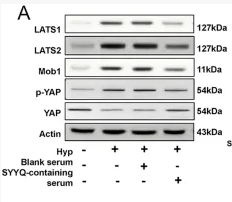 LATS1 Antibody - FIGURE 6 SYYQ reverses the downregulation of miR-302a-3p and the activation of Hippo pathway in Hyp MCMECs.