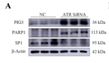 PIG3 Antibody - Figure 5.