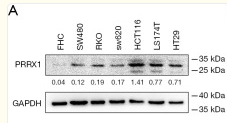 PRRX1 Antibody - Figure 2.