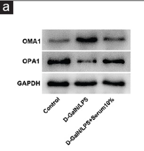 OMA1 Antibody - Figure 7 Niujiaodihuang Detoxify Decoction (NDD) medicated serum improves mitochondrial function via mitochondrial homeostasis regulated by the OMA1-OPA1 pathway in LO2 cells.
