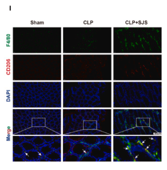 MRC1/CD206 Antibody - Fig.