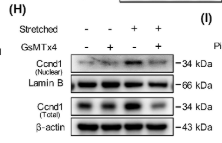Lamin B1 Antibody - FIGURE 3 Piezo1 modulates macrophage proliferation via activation of PI3K-AKT pathway and Ccnd1.