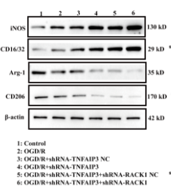 MRC1/CD206 Antibody - Fig 3.