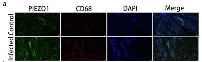 Piezo1 Antibody - Fig.